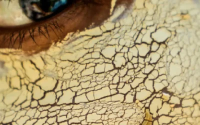 Perché la pelle tira anche se metto la crema?